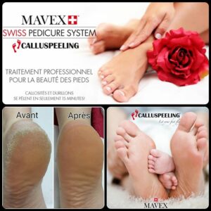Mise en beauté des pieds CALLUSPELLING