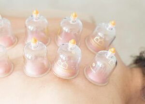 Massage du Monde : Ventouses